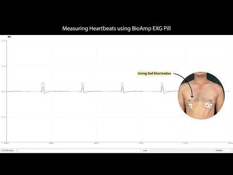 Heartbeat Detection using BioAmp EXG Pill | ECG